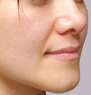 gal3-before