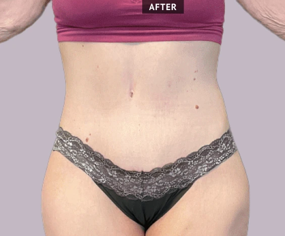 before and after images (2)