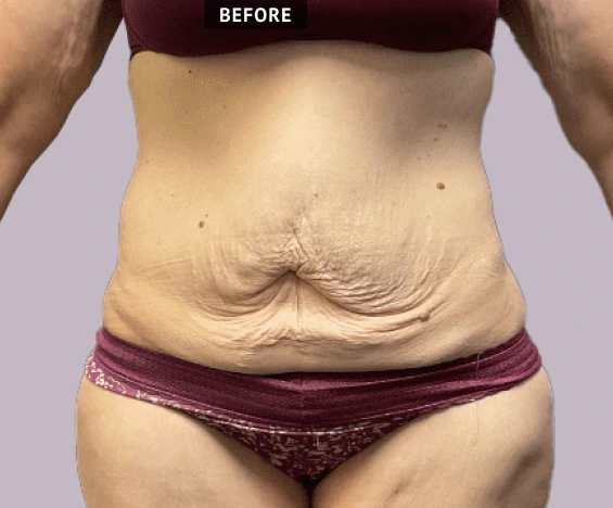 before and after images (3)
