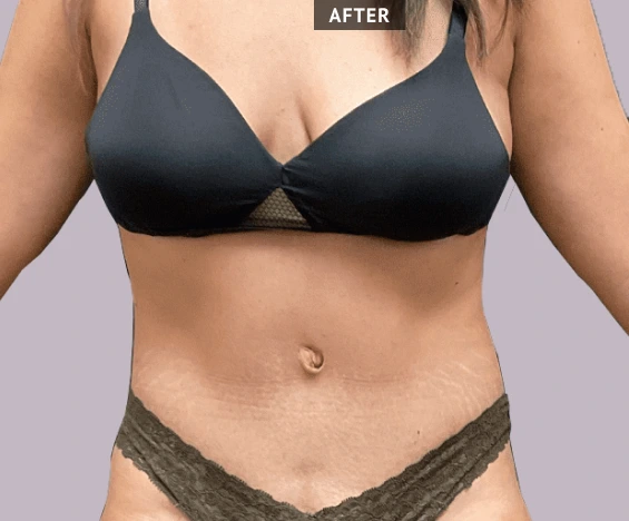 before and after images (4)