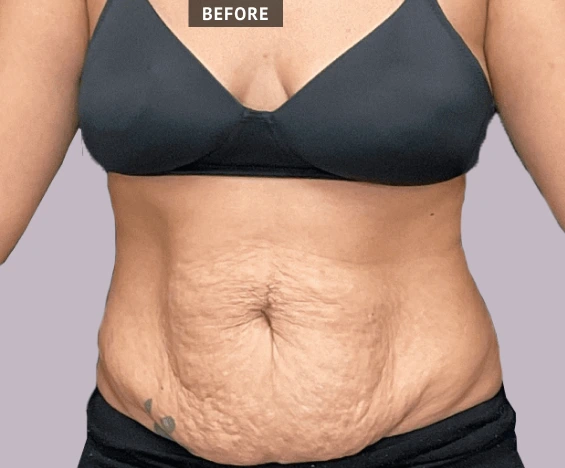before and after images (5)