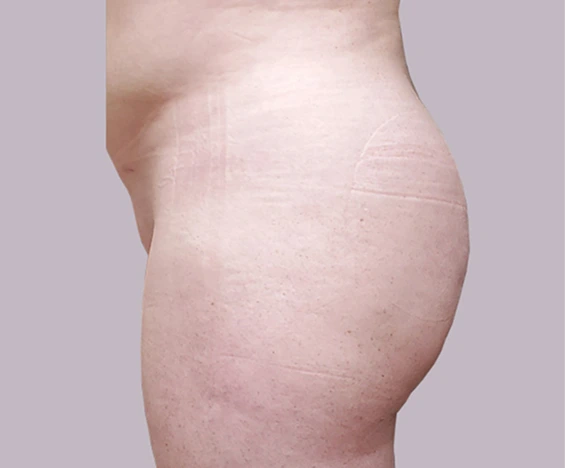 before and after images (6)