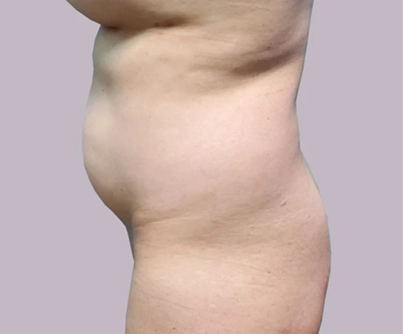 before and after images (7)