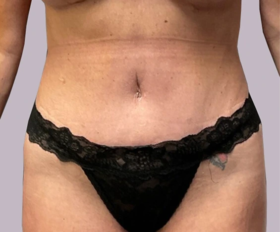 before and after images (8)